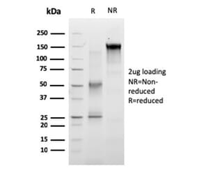 SDS-PAGE - Anti-RET Antibody [RET/2663] (A249881) - Antibodies.com