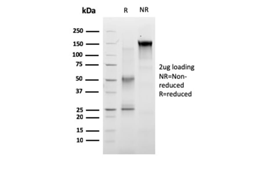SDS-PAGE - Anti-RET Antibody [RET/2663] (A249881) - Antibodies.com