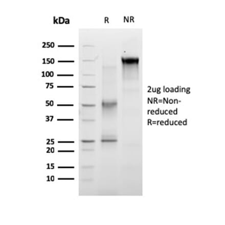 SDS-PAGE - Anti-RET Antibody [RET/2663] (A249881) - Antibodies.com