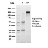 SDS-PAGE - Anti-RET Antibody [RET/2663] (A249881) - Antibodies.com