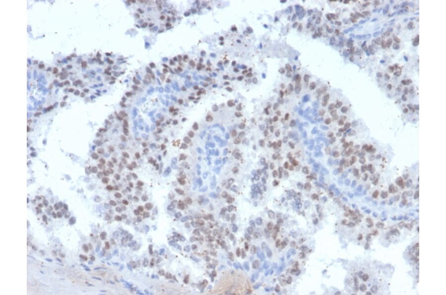 Immunohistochemistry - Anti-RET Antibody [RET/2663] (A249881) - Antibodies.com