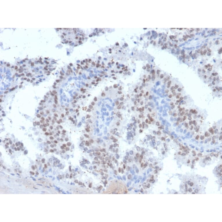 Immunohistochemistry - Anti-RET Antibody [RET/2663] (A249881) - Antibodies.com