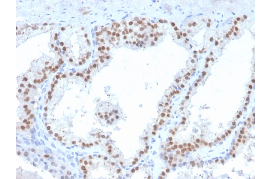 Immunohistochemistry - Anti-RET Antibody [RET/2663] (A249881) - Antibodies.com