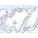 Immunohistochemistry - Anti-RET Antibody [RET/2663] (A249881) - Antibodies.com