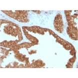 Immunohistochemistry - Anti-RET Antibody [RET/2795] (A249882) - Antibodies.com