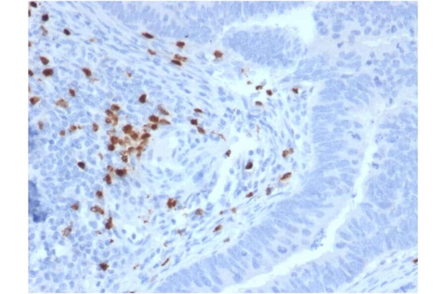 Immunohistochemistry - Anti-RET Antibody [RET/2795] (A249882) - Antibodies.com