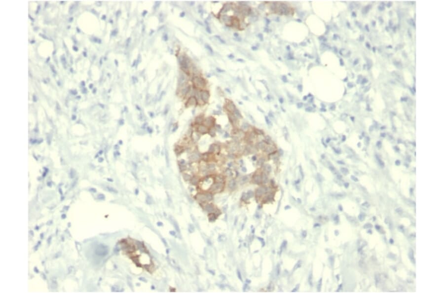 Immunohistochemistry - Anti-RET Antibody [RET/2795] (A249882) - Antibodies.com
