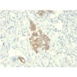 Immunohistochemistry - Anti-RET Antibody [RET/2795] (A249882) - Antibodies.com