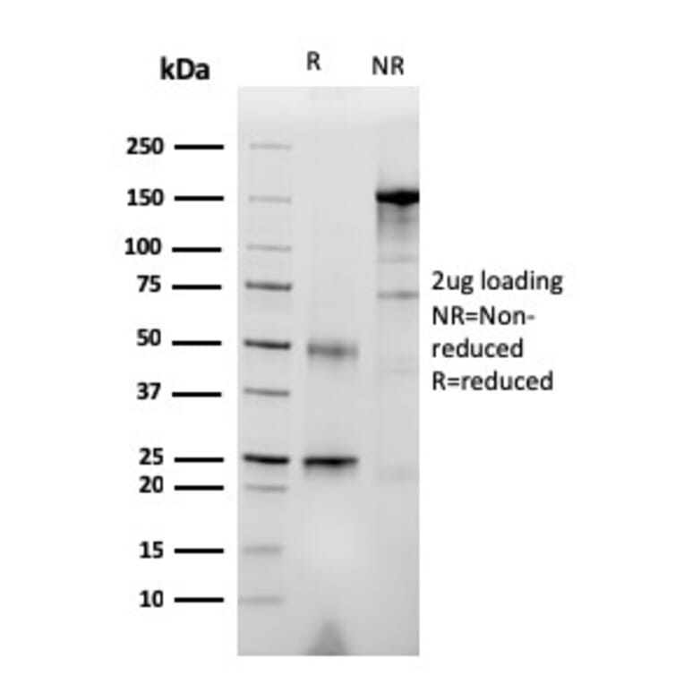 SDS-PAGE - Anti-RET Antibody [RET/2976] (A249883) - Antibodies.com