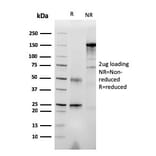 SDS-PAGE - Anti-RET Antibody [RET/2976] (A249883) - Antibodies.com