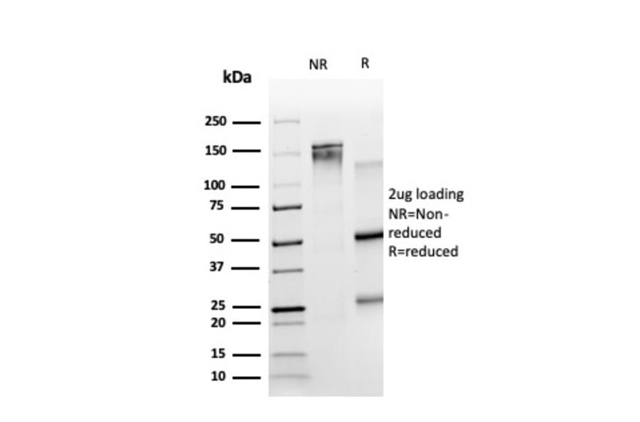 SDS-PAGE - Anti-TRIM27 Antibody [PCRP-TRIM27-1B3] (A249884) - Antibodies.com