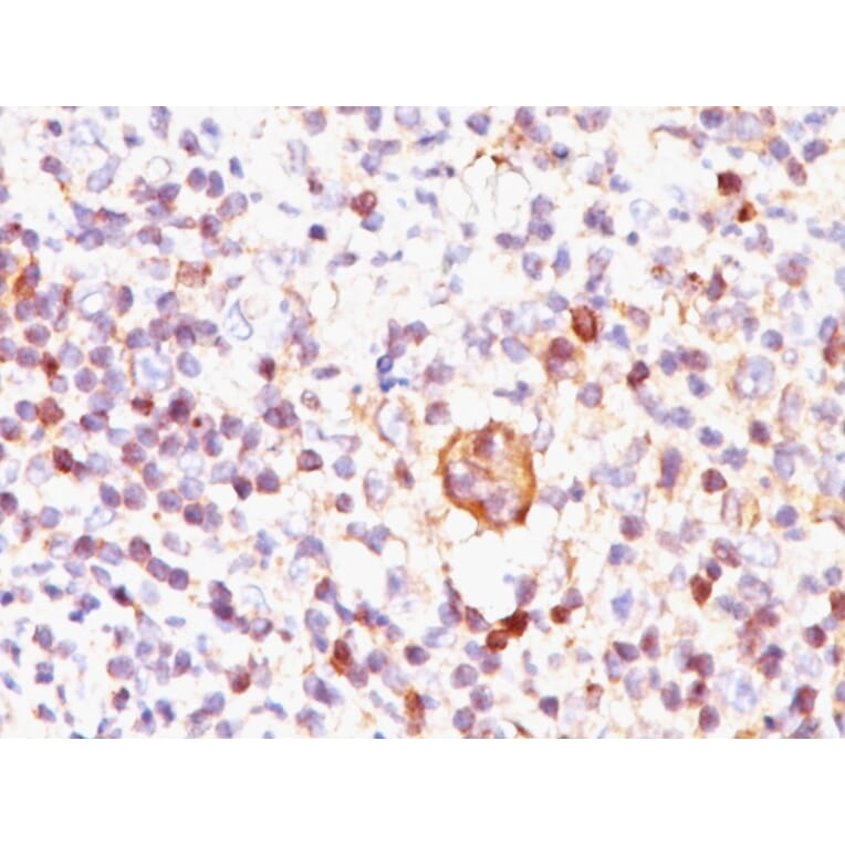 Immunohistochemistry - Anti-Bcl-X Antibody [BX006] (A253069) - Antibodies.com