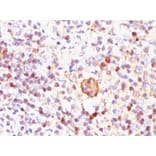 Immunohistochemistry - Anti-Bcl-X Antibody [BX006] (A253069) - Antibodies.com