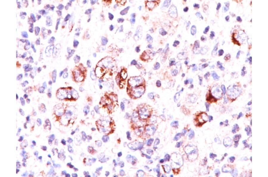Immunohistochemistry - Anti-Bcl-X Antibody [2H12] (A249885) - Antibodies.com