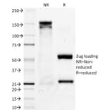 SDS-PAGE - Anti-Bcl-X Antibody [2H12] (A249886) - Antibodies.com