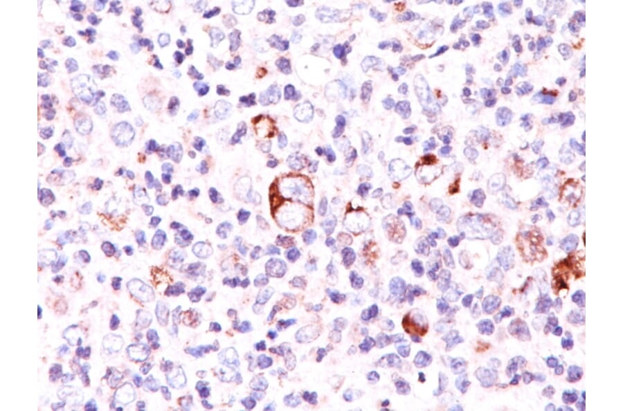 Immunohistochemistry - Anti-Bcl-X Antibody [SPM165] (A249886) - Antibodies.com