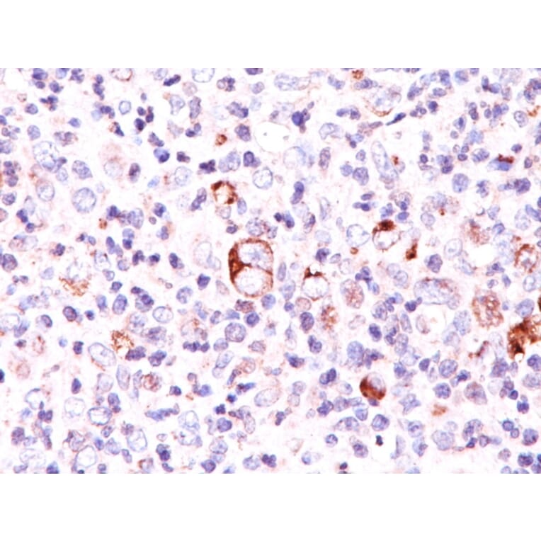 Immunohistochemistry - Anti-Bcl-X Antibody [SPM165] (A249886) - Antibodies.com