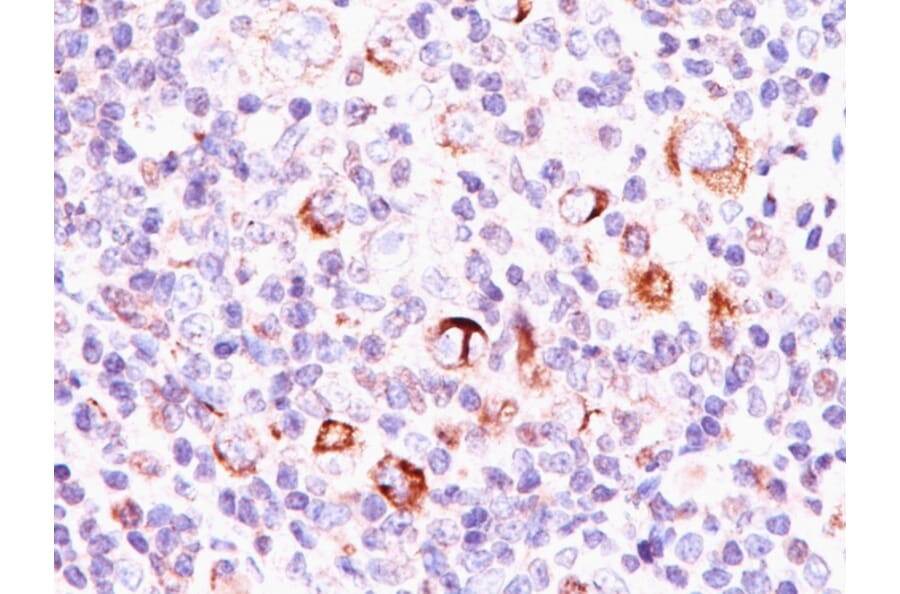 Immunohistochemistry - Anti-Bcl-X Antibody [SPM337] (A249887) - Antibodies.com