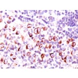 Immunohistochemistry - Anti-Bcl-X Antibody [BX006 + 2H12] (A249888) - Antibodies.com