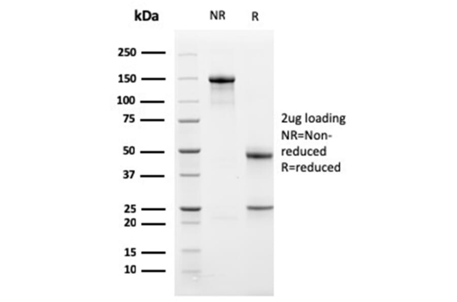 SDS-PAGE - Anti-Bcl-X Antibody [BCL2L1/1762] (A249889) - Antibodies.com