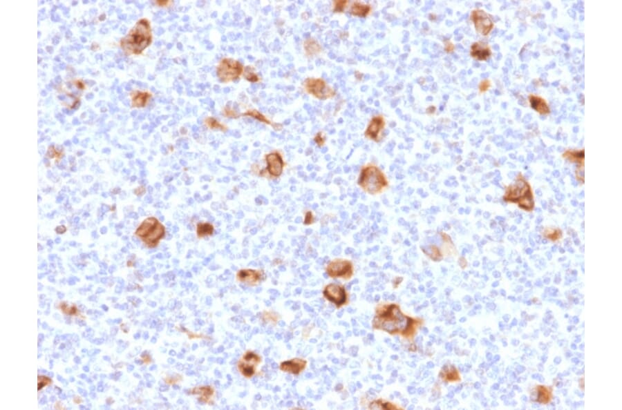 Immunohistochemistry - Anti-Bcl-X Antibody [SPM519] (A253068) - Antibodies.com