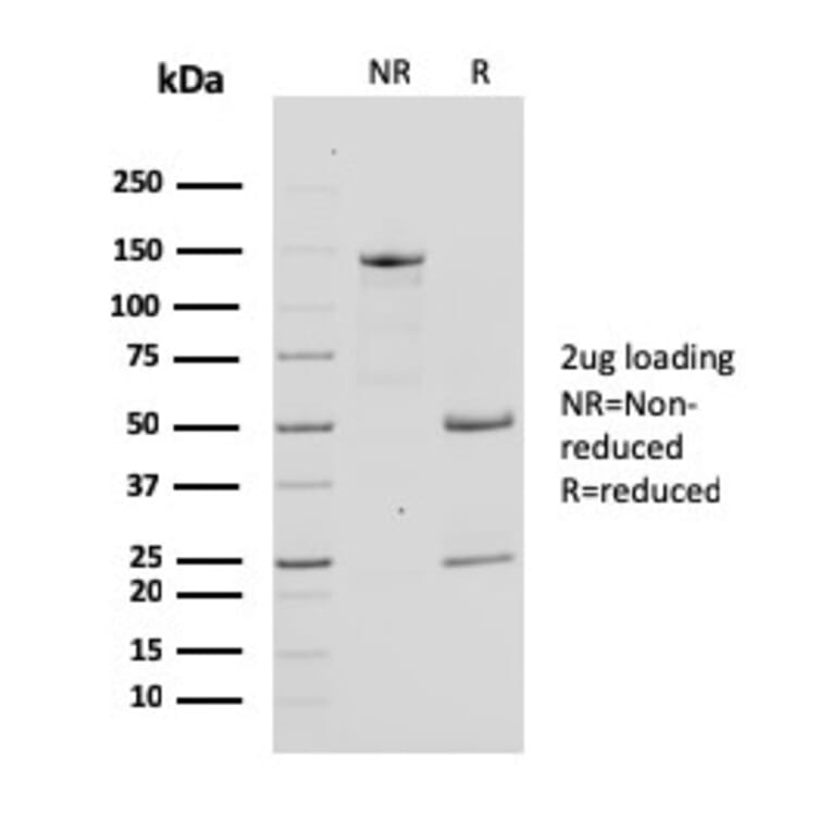 SDS-PAGE - Anti-Bcl-X Antibody [SPM519] (A278502) - Antibodies.com