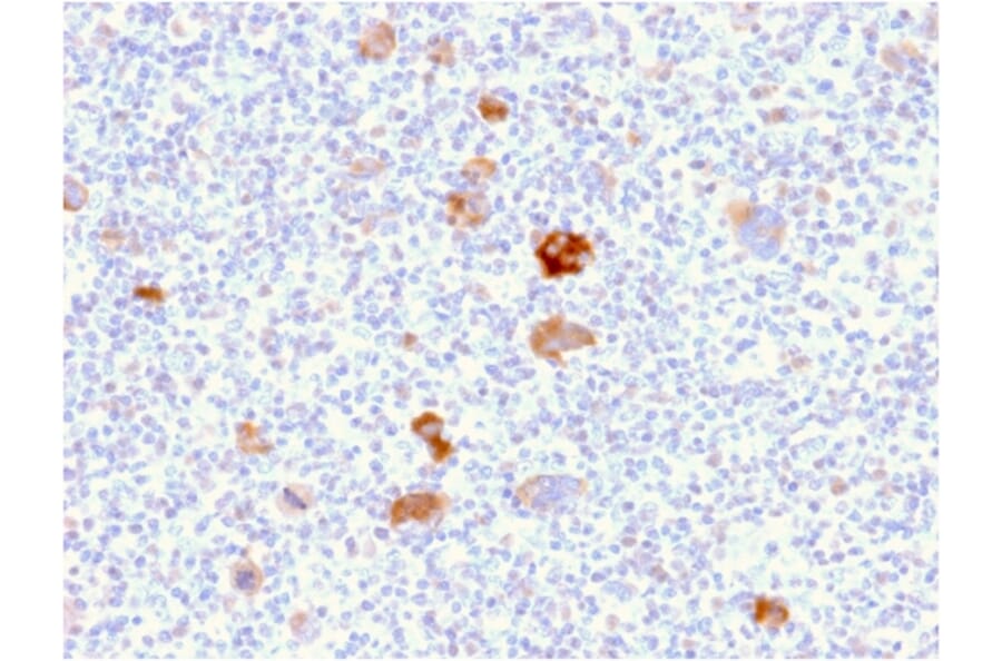 Immunohistochemistry - Anti-Bcl-X Antibody [BCL2L1/2406] (A249892) - Antibodies.com