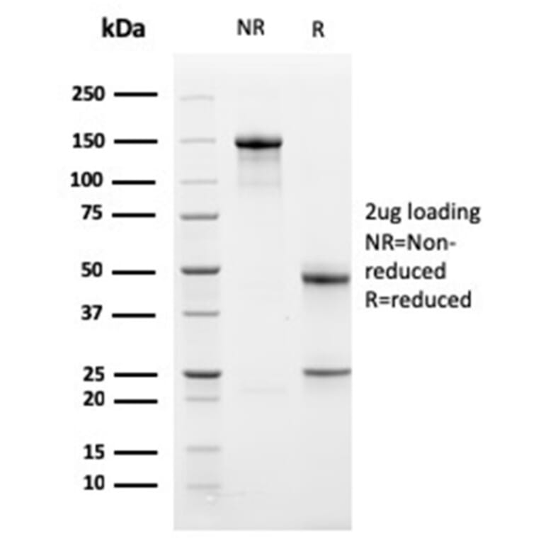 SDS-PAGE - Anti-Bcl-X Antibody [BCL2L1/2406] (A249892) - Antibodies.com