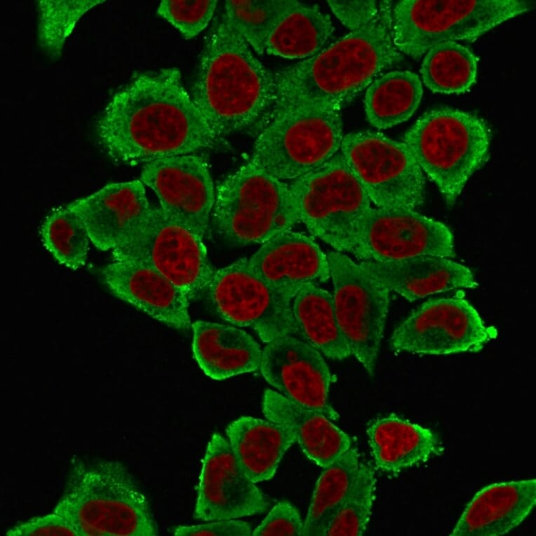Immunofluorescence - Anti-alpha Smooth Muscle Actin Antibody [1A4] (A249894) - Antibodies.com