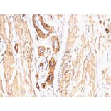 Immunohistochemistry - Anti-alpha Smooth Muscle Actin Antibody [SPM332] (A249895) - Antibodies.com