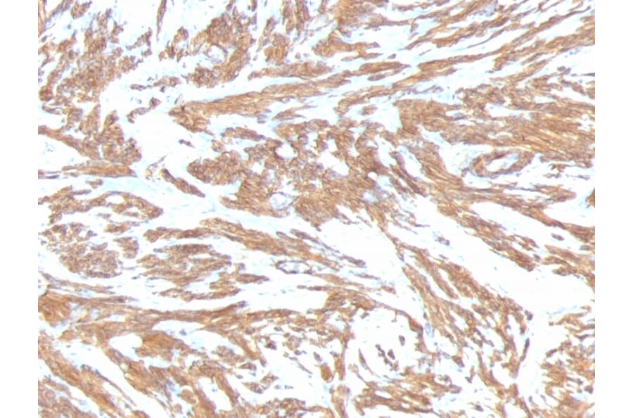 Immunohistochemistry - Anti-alpha Smooth Muscle Actin Antibody [ACTA2/791] (A249896) - Antibodies.com