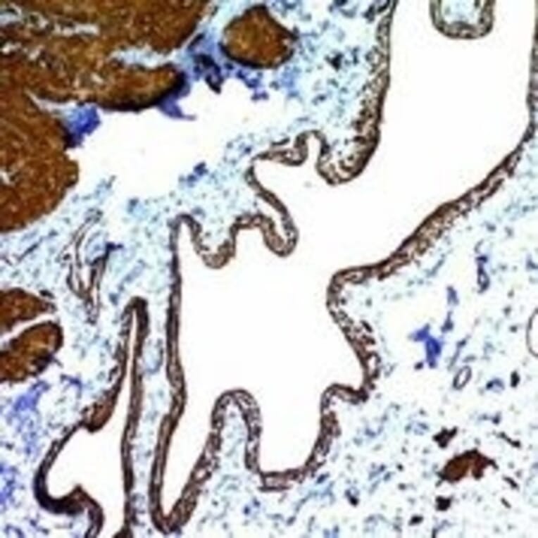 Immunohistochemistry - Anti-alpha Smooth Muscle Actin Antibody [ACTA2/791] (A249896) - Antibodies.com