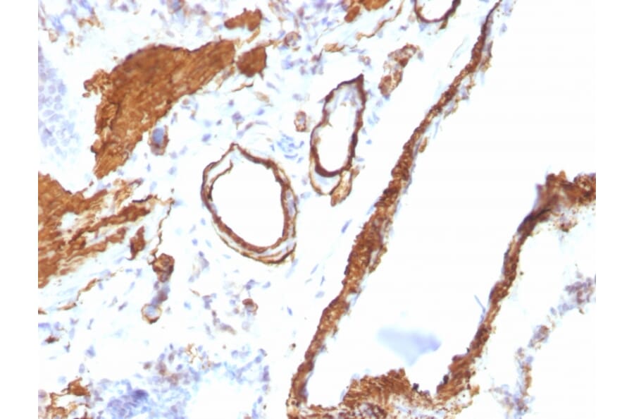 Immunohistochemistry - Anti-alpha Smooth Muscle Actin Antibody [ACTA2/791] (A249896) - Antibodies.com