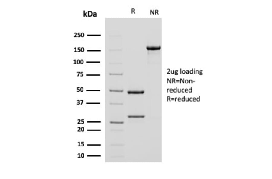 SDS-PAGE - Anti-alpha Smooth Muscle Actin Antibody [ACTA2/791] (A249896) - Antibodies.com
