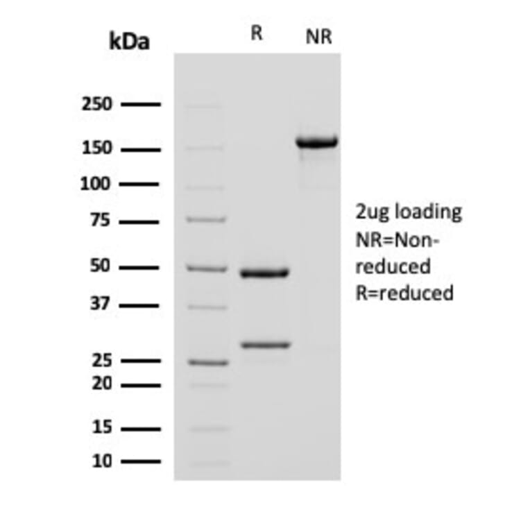 SDS-PAGE - Anti-alpha Smooth Muscle Actin Antibody [ACTA2/791] (A249896) - Antibodies.com