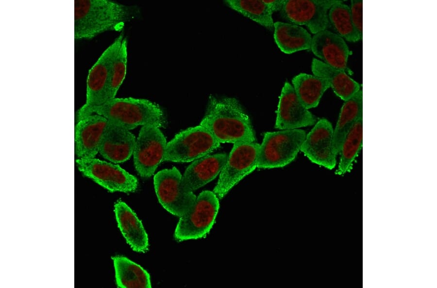 Immunofluorescence - Anti-alpha Smooth Muscle Actin Antibody [ACTA2/791] (A249895) - Antibodies.com