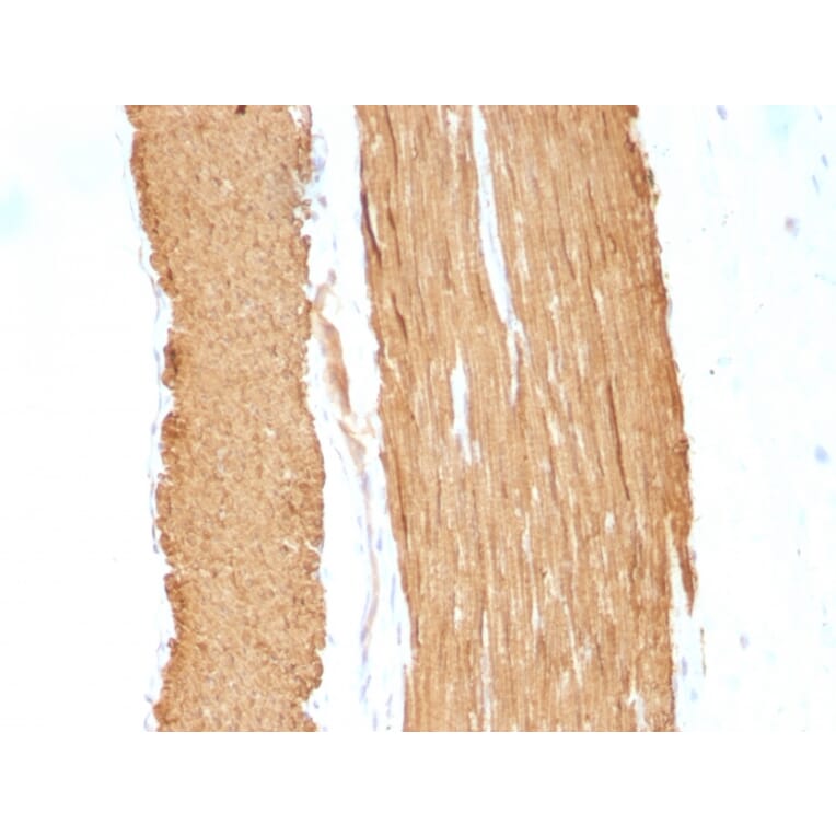 Immunohistochemistry - Anti-alpha Smooth Muscle Actin Antibody [1A4 + ACTA2/791] (A249897) - Antibodies.com