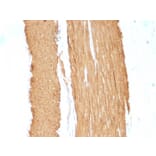 Immunohistochemistry - Anti-alpha Smooth Muscle Actin Antibody [1A4 + ACTA2/791] (A249897) - Antibodies.com