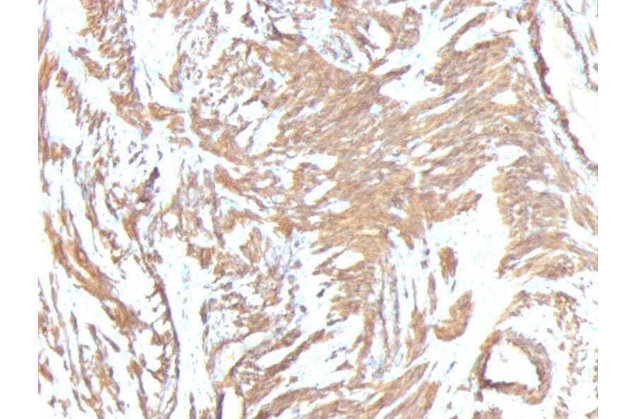 Immunohistochemistry - Anti-alpha Smooth Muscle Actin Antibody [1A4 + ACTA2/791] (A249897) - Antibodies.com