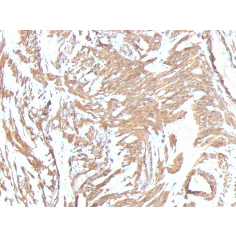 Immunohistochemistry - Anti-alpha Smooth Muscle Actin Antibody [1A4 + ACTA2/791] (A249897) - Antibodies.com