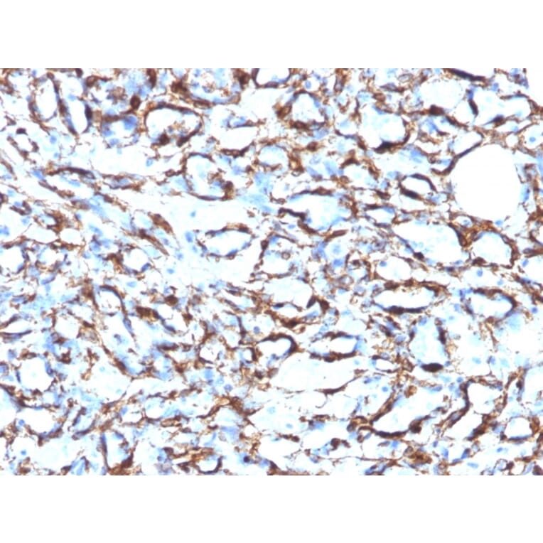 Immunohistochemistry - Anti-alpha Smooth Muscle Actin Antibody [1A4 + ACTA2/791] (A249897) - Antibodies.com