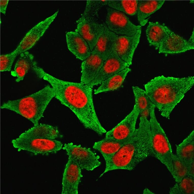 Immunofluorescence - Anti-alpha Smooth Muscle Actin Antibody [1A4 + ACTA2/791] (A249896) - Antibodies.com