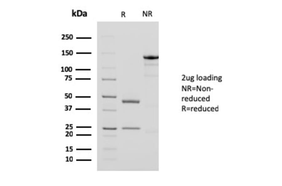 SDS-PAGE - Anti-alpha Smooth Muscle Actin Antibody [1A4 + ACTA2/791] (A249897) - Antibodies.com
