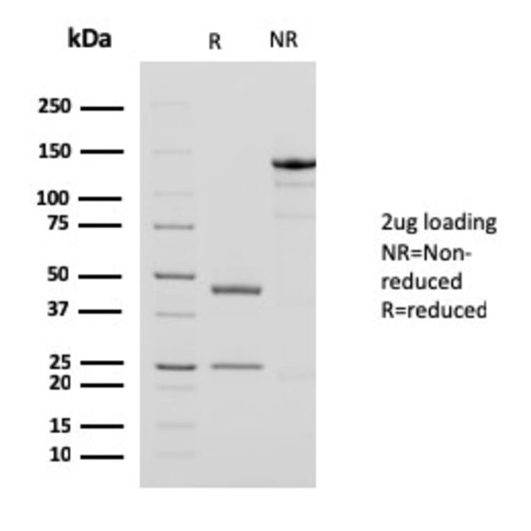 SDS-PAGE - Anti-alpha Smooth Muscle Actin Antibody [1A4 + ACTA2/791] (A249897) - Antibodies.com