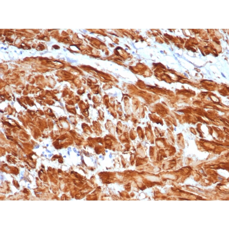 Immunohistochemistry - Anti-alpha Smooth Muscle Actin Antibody [rACTA2/1625] (A249898) - Antibodies.com