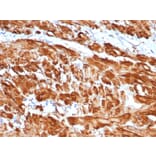 Immunohistochemistry - Anti-alpha Smooth Muscle Actin Antibody [rACTA2/1625] (A249898) - Antibodies.com
