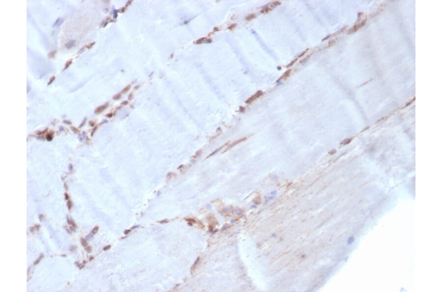 Immunohistochemistry - Anti-alpha Smooth Muscle Actin Antibody [rACTA2/1625] (A249897) - Antibodies.com