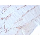 Immunohistochemistry - Anti-alpha Smooth Muscle Actin Antibody [rACTA2/1625] (A249897) - Antibodies.com