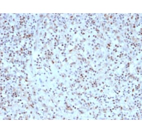 Immunohistochemistry - Anti-Bcl-6 Antibody [rBCL6/1527] (A249899) - Antibodies.com