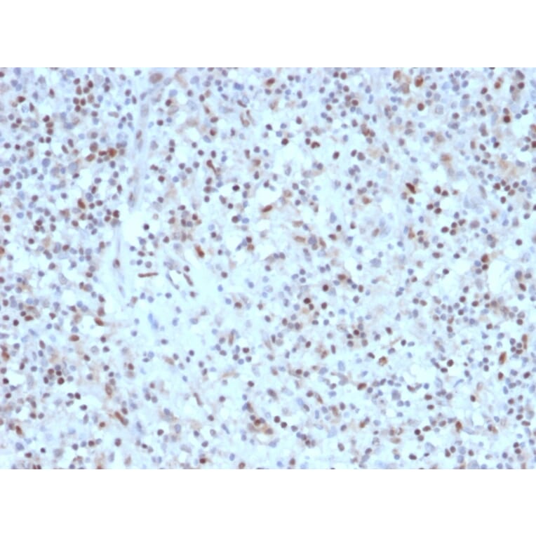 Immunohistochemistry - Anti-Bcl-6 Antibody [rBCL6/1527] (A249899) - Antibodies.com